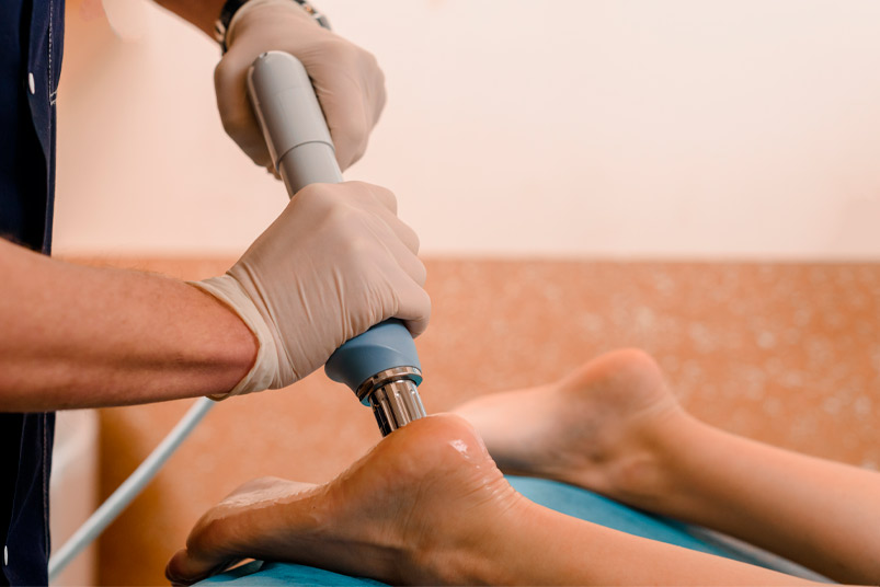 Physical therapy of foot with acoustic shock waves, closeup photo