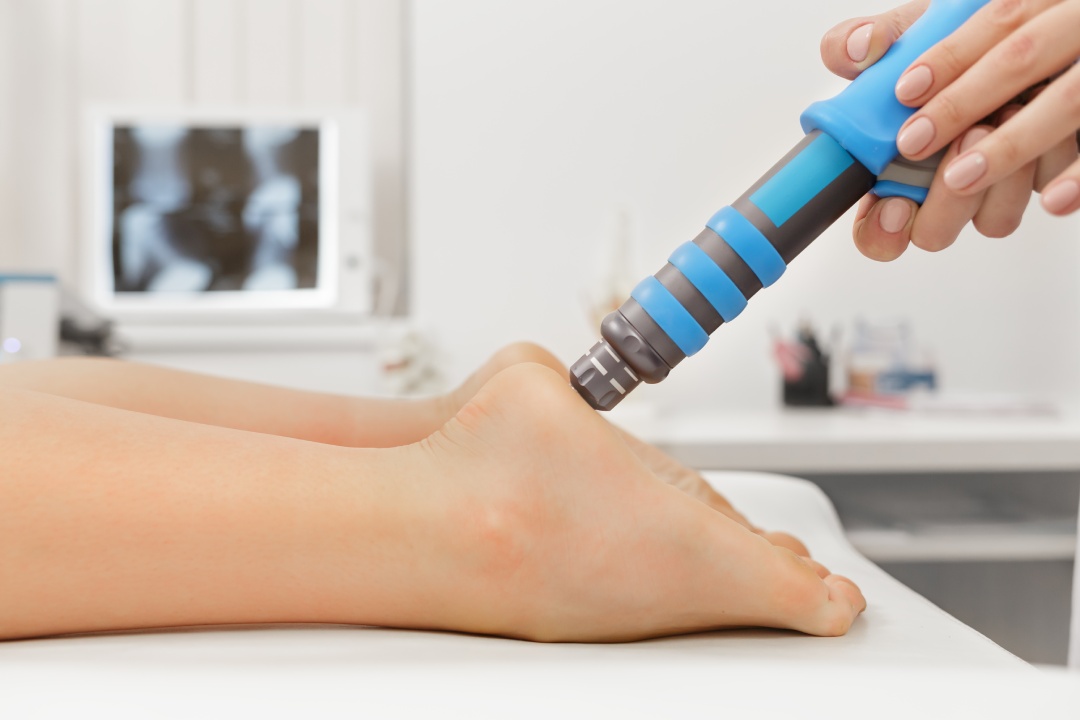 Extracorporeal Shockwave Therapy ESWT.Effective non-surgical treatment.Physical therapy for plantarfascitis with shock waves.Pain relief, normalization and regeneration,stimulation of healing process.